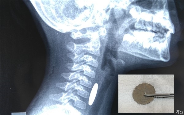 PT images