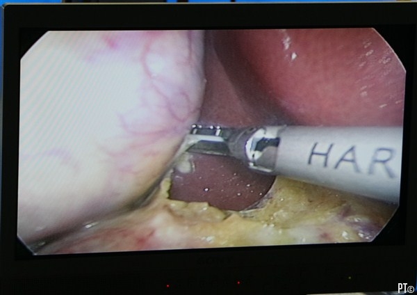 PT images