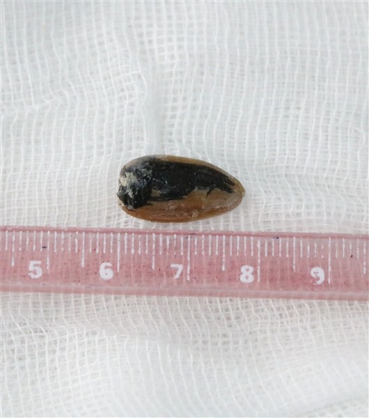PT images