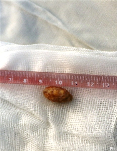 PT images