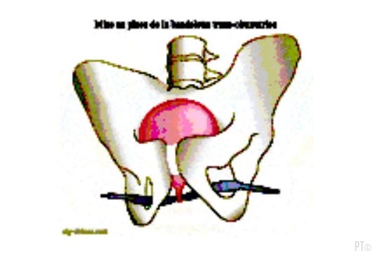 PT images