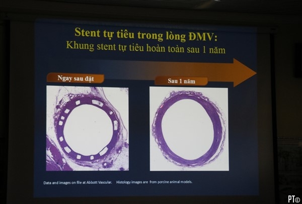 PT images