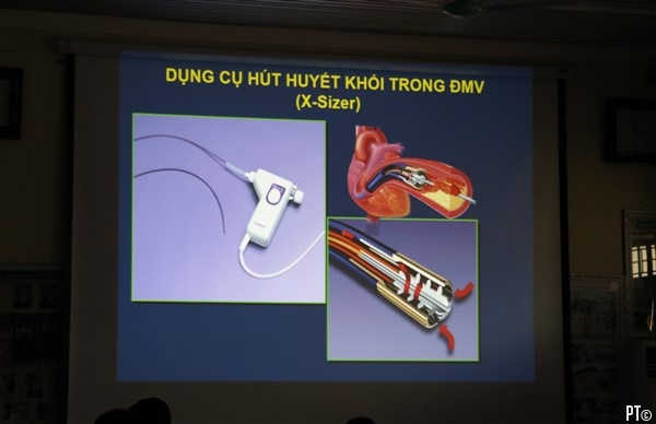PT images